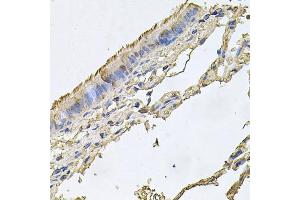 Immunohistochemistry of paraffin-embedded human trachea using FABP12 antibody. (FABP12 抗体)
