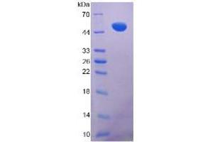 SDS-PAGE analysis of Mouse VIM Protein. (Vimentin Protein (VIM))
