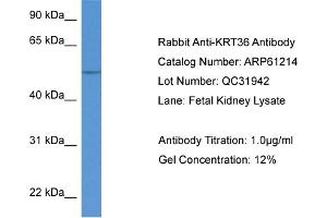 Western Blotting (WB) image for anti-Keratin 36 (KRT36) (N-Term) antibody (ABIN2788722) (Keratin 36 抗体  (N-Term))