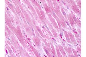 Immunohistochemistry (IHC) image for anti-Protein tyrosine Phosphatase, Receptor Type, A (PTPRA) (Cytoplasmic Domain) antibody (ABIN1049270)