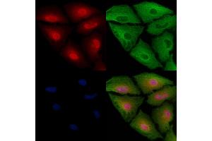 ABIN6263080 and ABIN6272519 staining  cells by IF/ICC.
