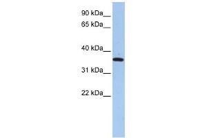 FAM84A antibody used at 1 ug/ml to detect target protein. (FAM84A 抗体  (N-Term))