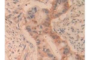 Immunohistochemistry (IHC) image for anti-Pyruvate Kinase, Liver and RBC (PKLR) (AA 219-420) antibody (ABIN7431302)