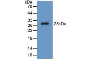 Detection of Recombinant PAH, Human using Polyclonal Antibody to Phenylalanine Hydroxylase (PAH) (Phenylalanine Hydroxylase 抗体  (AA 1-226))