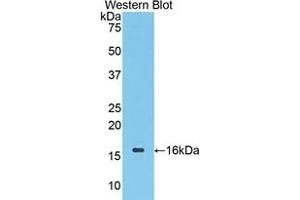 Detection of Recombinant CDK1, Mouse using Polyclonal Antibody to Cyclin Dependent Kinase 1 (CDK1) (CDK1 抗体  (AA 59-181))