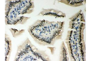 Anti- PKC epsilon Picoband antibody, IHC(P) IHC(P): Mouse Intestine Tissue (PKC epsilon 抗体  (AA 53-236))