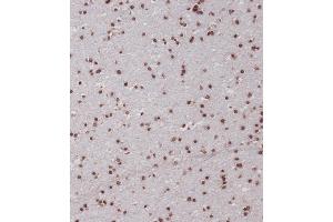 Immunohistochemistry (Paraffin-embedded Sections) (IHC (p)) image for anti-Single-Minded Homolog 1 (SIM1) (AA 1-30), (N-Term) antibody (ABIN656884)