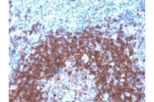 IHC testing of FFPE human tonsil with recombinant CD79a antibody (clone IGA/1790R). (Recombinant CD79a 抗体  (AA 202-216))