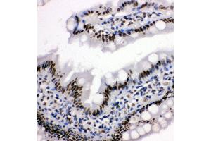 Anti-HDAC3 antibody,  IHC(P) IHC(P): Rat Intestine Tissue (HDAC3 抗体  (C-Term))