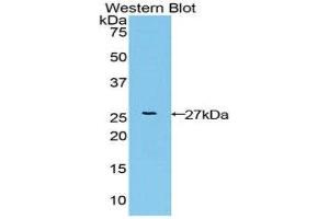 Western Blotting (WB) image for anti-Fibroblast Growth Factor Receptor-Like 1 (FGFRL1) (AA 168-378) antibody (ABIN3202407) (FGFRL1 抗体  (AA 168-378))