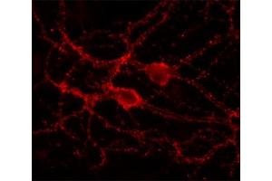 Indirect immunolabeling of cultured rat hippocampus neurons (dilution 1 : 500). (DNAJC5 抗体  (C-Term))