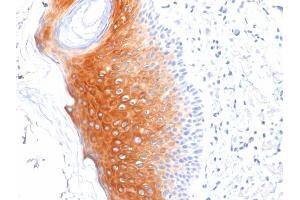 Formalin-fixed, paraffin-embedded human Skin stained with Cytokeratin 1 Mouse Monoclonal Antibody (LHK1). (Cytokeratin 1 抗体  (C-Term))