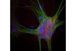 Immunofluorescence of Alpha-synuclein (Mouse) Antibody Immunofluorescence Microscopy of Alpha-synuclein (Mouse) Antibody.