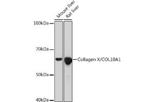 Western blot analysis of extracts of various cell lines, using Collagen X/COL10 Rabbit mAb (1645) at 1:1000 dilution. (COL10A1 抗体)