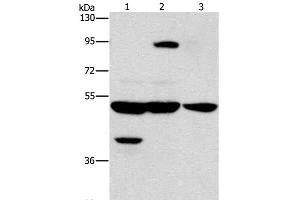 Western Blot analysis of Human bladder carcinoma tissue and A172 cell, Human brain malignant glioma tissue using STK4 Polyclonal Antibody at dilution of 1:1000 (STK4 抗体)
