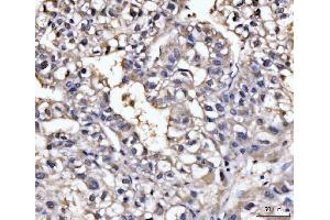 IHC analysis of GHITM using anti-GHITM antibody (ABIN7599294).
