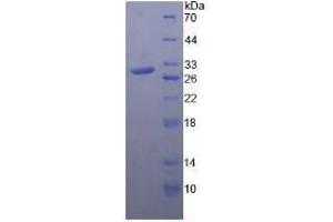 SDS-PAGE analysis of Rat Toll Like Receptor 4 Protein. (TLR4 蛋白)