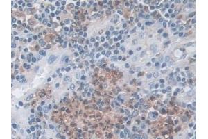 Immunohistochemistry (IHC) image for anti-Tripeptidyl Peptidase I (TPP1) (AA 1-320) antibody (ABIN7435157)