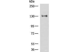 Western blot analysis of Hela cell lysate using PRPF40A Polyclonal Antibody at dilution of 1:800 (PRPF40A 抗体)