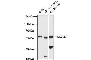 Western blot analysis of extracts of various cell lines, using MG antibody (ABIN6131880, ABIN6143811, ABIN6143812 and ABIN6224904) at 1:1000 dilution. (MGAT2 抗体  (AA 178-447))