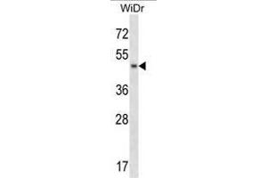 anti-Ankyrin Repeat and Sterile alpha Motif Domain Containing 4B (ANKS4B) (AA 183-213), (Middle Region) antibody