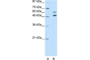WB Suggested Anti-ZNF682 Antibody Titration:  2. (ZNF682 抗体  (N-Term))
