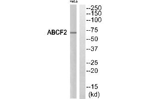 Western blot analysis of extracts from HeLa cells, using ABCF2 antibody. (ABCF2 抗体)