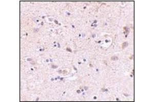 Immunohistochemistry of SATB2 in human brain with this product at 5 μg/ml.