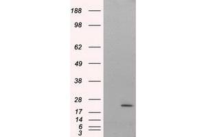 HEK293T cells were transfected with the pCMV6-ENTRY control (Left lane) or pCMV6-ENTRY NIT2 (Right lane) cDNA for 48 hrs and lysed. (NIT2 抗体)
