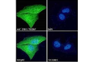 ABIN184711 Immunofluorescence analysis of paraformaldehyde fixed U251 cells, permeabilized with 0. (CYTIP 抗体  (N-Term))