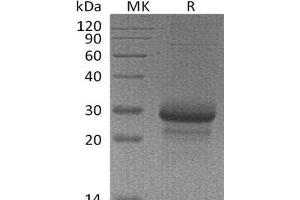 Western Blotting (WB) image for Mannose-Binding Lectin (Protein C) 2, Soluble (MBL2) protein (ABIN7320615) (MBL2 蛋白)
