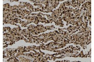 ABIN6277729 at 1/100 staining Human lung tissue by IHC-P. (LATS2 抗体  (Internal Region))