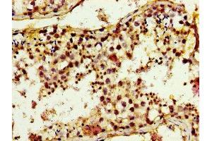 Immunohistochemistry of paraffin-embedded human testis tissue using ABIN7173435 at dilution of 1:100 (TRIM3 抗体  (AA 285-487))
