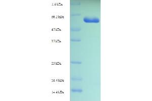 CPA6 Protein (AA 130-437) (His-SUMO Tag)
