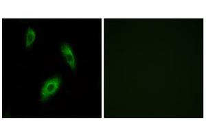 Immunofluorescence analysis of LOVO cells, using GPR174 antibody. (GPR174 抗体  (Internal Region))