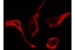 Immunofluorescence (fixed cells) (IF/ICC) image for anti-NADPH Oxidase 1 (NOX1) (C-Term) antibody (ABIN6263693)