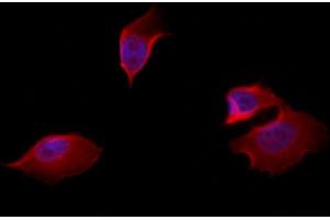 ABIN6257824 and ABIN6274609 staining Hela by IF/ICC. (CADM3 抗体  (Internal Region))