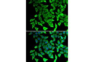 Immunofluorescence analysis of  cells using PTGES2 antibody (ABIN6129084, ABIN6146403, ABIN6146405 and ABIN6217438). (PTGES2 抗体  (AA 88-377))