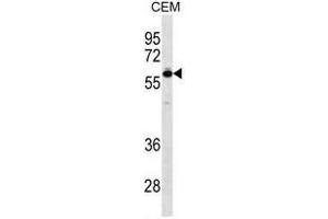 TBX5 Antibody (N-term) western blot analysis in CEM cell line lysates (35ug/lane). (T-Box 5 抗体  (N-Term))