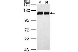WB Image Sample (30 ug of whole cell lysate) A: H1299 B: Hela 7. (KAP1 抗体)