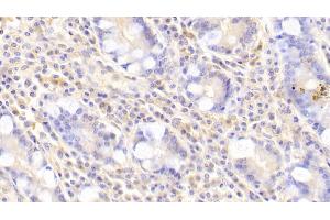 Immunohistochemistry (IHC) image for anti-Guanine Nucleotide Binding Protein (G Protein), beta Polypeptide 2 (GNB2) (AA 2-340) antibody (ABIN7443239)