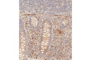 Immunohistochemical analysis of paraffin-embedded human epityphlon tissue using (ABIN392563 and ABIN2842106) performed on the Leica® BOND RXm. (PIK3CD 抗体  (C-Term))