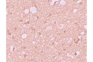 Immunohistochemical staining of human brain cells with SESTD1 polyclonal antibody  at 5 ug/mL. (SESTD1 抗体  (C-Term))