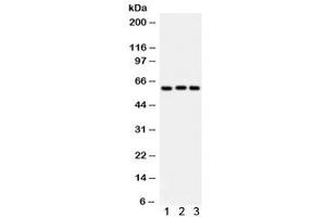 Western blot testing of 1) rat liver, 2) human placenta, 3) A549 lysate with Heparanase 1 antibody.