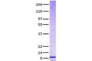 Validation with Western Blot (CCL24 蛋白)