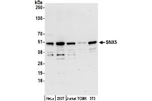 Western Blotting (WB) image for anti-Sorting Nexin 5 (SNX5) (AA 1-50) antibody (ABIN7451027)