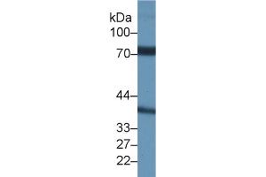 Western Blot; Sample: Rat Testis lysate; Primary Ab: 1µg/ml Rabbit Anti-Rat NCSTN Antibody Second Ab: 0. (Nicastrin 抗体  (AA 35-534))