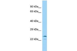 Host: Rabbit Target Name: IYD Sample Type: 293T Whole Cell lysates Antibody Dilution: 1. (IYD 抗体  (N-Term))