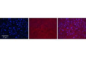 Immunohistochemistry (IHC) image for anti-Solute Carrier Family 37 (Glucose-6-Phosphate Transporter), Member 4 (SLC37A4) (Middle Region) antibody (ABIN2781570)