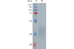 Human TNFB Protein, His Tag on SDS-PAGE under reducing condition.